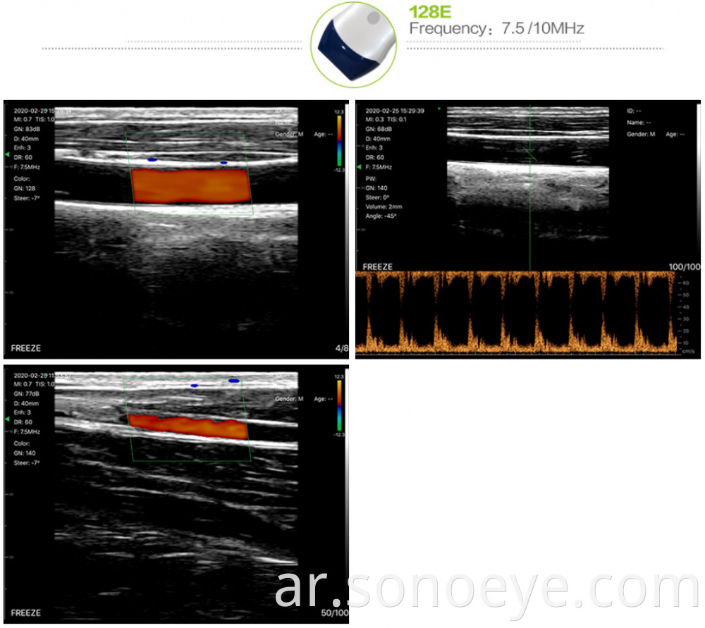 Linear Color Sonostar Pocket Ultrasound Wireless Probe